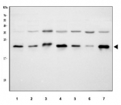 Western blot testing of 1) human MCF7, 2) human U-87 MG, 3) rat H9C2, 4) rat heart, 5) rat C2C12, 6) mouse skeletal muscle and 7) mouse heart lysate with HSP22 antibody at 0.5ug/ml. Observed molecular weight: 22-27 kDa.