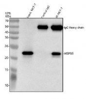 Immunoprecipitation of HSP22 protein from 500ug of human MCF7 whole cell lysate with 2ug of HSP22 antibody.
