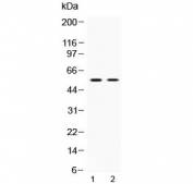 Western blot testing of 1) rat stomach and 2) mouse ovary lysate with ANGPTL2 antibody at 0.5ug/ml. Predicted molecular weight ~57 kDa.