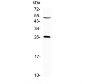 Western blot testing of mouse NIH3T3 cell lysate with CTLA-4 antibody at 0.5ug/ml. Predicted molecular weight ~25 kDa but may be observed at higher molecular weights due to glycosylation.