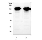 Western blot testing of 1) rat liver and 2) mouse liver tissue lysate with Flt3 antibody at 0.5ug/ml. Predicted molecular weight: ~113 kDa (unmodified), ~130/160 kDa (glycosylated).