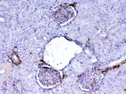 IHC testing of FFPE rat kidney tissue with Galectin 1 antibody at 1ug/ml. Required HIER: steam section in pH6 citrate buffer for 20 min and allow to cool prior to testing.