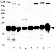 Western blot testing of rat 1) pancreas, 2) kidney, 3) skeletal muscle, 4) liver, 5) testis, 6) heart, 7) mouse kidney and 8) mouse skeletal muscle lysate with Park7 antibody at 0.5ug/ml. Predicted molecular weight ~20 kDa. 