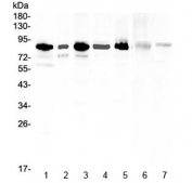 Western blot testing of human 1) U-87MG, 2) U-2 OS, 3) HeLa, 4) 22RV1, 5) K562, 6) rat liver and 7) mouse thymus lysate with MED15 antibody at 0.5ug/ml. Predicted molecular weight ~87 kDa.