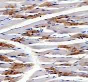 IHC staining of FFPE rat skeletal muscle tissue with Myoglobin antibody. HIER: boil tissue sections in pH8 EDTA for 20 min and allow to cool before testing.