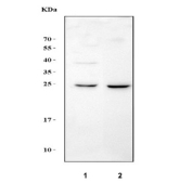 Western blot testing of 1) rat thymus and 2) mouse thymus tissue lysate with Flt3 ligand antibody at 0.5ug/ml. Predicted molecular weight ~26 kDa.