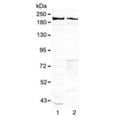 Western blot tesing of rat 1) brain and 2) testis lysate with Neurocan antibody at 0.5ug/ml. Predicted molecular weight ~143 kDa (unmodified), up to ~250 kDa (fully glycosylated).
