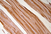 IHC staining of FFPE human skeletal muscle with HSP20 antibody. HIER: boil tissue sections in pH8 EDTA for 20 min and allow to cool before testing.