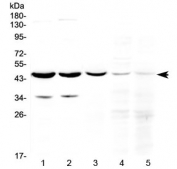 Western blot testing of 1) rat brain, 2) mouse brain, 3) human U-87MG (glioma), 4) human Jurkat and 5) human HeLa cell lysate with HOMER3 antibody at 0.5ug/ml. Predicted molecular weight ~40 kDa, can be observed at 45-47 kDa.