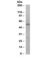 Western blot testing of Jurkat lysate with DBNL antibody at 1ug/ml. Predicted molecular weight: ~49kDa.