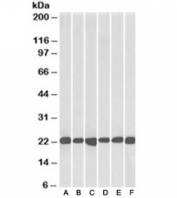 Western blot  of human cerebellum (A), human frontal cortex (B), human hippocampus (C) mouse fetal brain (D), mouse brain (E) and rat brain (F) lysates with DJ-1 antibody at 0.05ug/ml. Predicted molecular weight ~20 kDa.