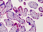 IHC staining of FFPE human placenta with ADAM12 antibody at 4ug/ml. HIER: steamed with pH6 citrate buffer, AP-staining.