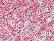 IHC testing of FFPE human cerebral cortex tissue with MOG antibody at 5ug/ml. Steamed antigen retrieval with citrate buffer pH 6, AP-staining.