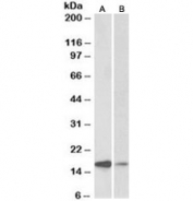 Western blot testing of human amygdala [A] and fetal mouse [B] brain lysate with alpha-Synuclein antibody at 0.1ug/ml. Predicted molecular weight ~15 kDa.