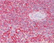 IHC testing of FFPE human spleen tissue with Clatherin Light Chain antibody at 2.5ug/ml. Required HIER: steamed antigen retrieval with pH6 citrate buffer; AP-staining.