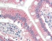 IHC testing of FFPE human small intestine tissue with RNF39 antibody at 10ug/ml. Required HIER: steam section in pH6 citrate buffer for 20 min and allow to cool prior to staining.