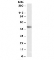Western blot testing of human testis lysate with NR0B1 antibody at 0.5ug/ml. Predicted molecular weight: 44-52 kDa (two isoforms).