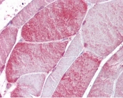 IHC testing of FFPE human skeletal muscle tissue with CSRP3 antibody at 2.5ug/ml. Required HIER: steamed antigen retrieval with pH6 citrate buffer; AP-staining.