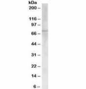 Western blot testing of human placenta lysate with ChAT antibody at 0.03ug/ml. Predicted molecular weight ~74 kDa.