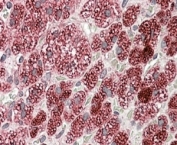 IHC staining of FFPE human adrenal gland with CYB5R3 antibody at 4ug/ml. HIER: steamed with pH6 citrate buffer, AP-staining.