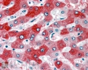 IHC staining of FFPE human liver tissue with 58K Golgi protein antibody at 3.8ug/ml. HIER: steamed with pH6 citrate buffer, AP-staining.