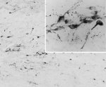 IHC testing of PFA-perfused cryosection of human hypothalamus and AGRP antibody at 0.05ug/ml.  HIER: pH6 citrate buffer at 80C for 30min, HRP-staining with Ni-DAB after biotin-SP-anti-goat amplification.