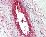IHC testing of FFPE human vessel with EHD2 antibody at ug/ml. HIER: steamed antigen retrieval with pH6 citrate buffer; AP-staining.
