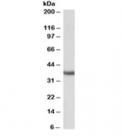 Western blot testing of mouse testis lysate with Clusterin antibody at 0.3ug/ml. Predicted molecular weight: 75-80kDa (heterodimer precursor), 36-39kDa (alpha subunit), 34-36kDa (beta subunit).