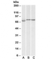 Western blot testing of human [A], mouse [B] and rat [C] testis lysate with DMTF1 antibody at 1ug/ml. Predicted molecular weight: ~84/75kDa (isoforms a/b).
