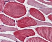 IHC staining of FFPE human skeletal muscle with AS160 antibody at 4ug/ml. HIER: steamed with pH6 citrate buffer, AP-staining.