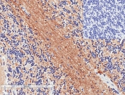 IHC staining of FFPE human cerebellum tissue with (left) and without (right) SNAP25 antibody at 1ug/ml. HIER: steamed with pH6 citrate buffer, HRP-staining.