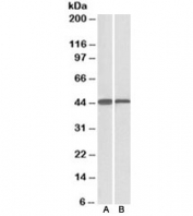 Western blot testing of mouse [A] and rat [B] liver lysate with ACAT1 antibody at 0.1ug/ml. Predicted molecular weight: ~45kDa.
