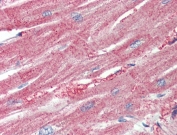 IHC testing of FFPE human heart tissue with ARPC1A antibody at 5ug/ml. Required HIER: steamed antigen retrieval with pH6 citrate buffer; AP-staining.