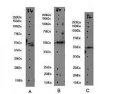 Western blot testing of A) human cerebral cortex, B) mouse brain and C) rat brain lysate with GFAP antibody. Predicted molecular weight ~50 kDa.