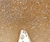 IHC staining of FFPE human cerebral cortex tissue with FTH1 antibody at 5ug/ml. Required HIER: steamed antigen retrieval with pH6 citrate buffer; HRP-staining.