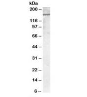 Western blot testing of human kidney lysate with PODXL antibody at 1ug/ml. Predicted molecular weight: isoform 1 observed at ~59/165kDa (unmodified/glycosylated), isoform 2 observed at 55/160kDa (unmodified/glycosylated).