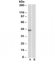 Western blot testing of HeLa nuclear [A] and cytosolic [B] lysate with TBP antibody at 0.3ug/ml. Predicted molecular weight ~38kDa.
