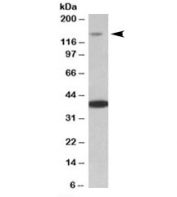 Western blot testing of mouse heart lysate with Irs4 antibody at 0.2ug/ml. The expected ~150kDa band and the additional ~39kDa band are both blocked by the immunizing peptide.