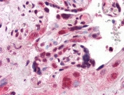 IHC testing of FFPE human placental tissue with ARA9 antibody at 5ug/ml. Required HIER: steamed antigen retrieval with pH6 citrate buffer; AP-staining.