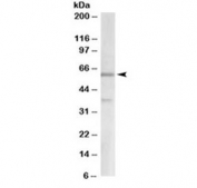 Western blot testing of human cerebellum lysate with VGLUT2 antibody at 2ug/ml. Molecular weight: the expected ~60 kDa band and the additional ~37 kDa band are both blocked by the immunizing peptide.