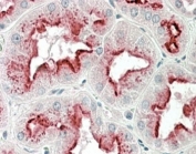 IHC staining of FFPE human kidney with Apolipoprotein D antibody at 5ug/ml. HIER: steamed with pH6 citrate buffer, AP-staining.