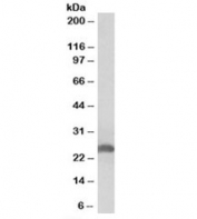 Western blot testing of human liver lysate with Apolipoprotein D antibody at 0.3ug/ml. Predicted molecular weight: ~21/21-33kDa (unmodified/glycosylated). 