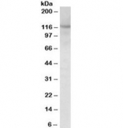 Western blot testing of mouse fetal brain lysate with SIRT1 antibody at 1ug/ml. Predicted molecular weight ~80kDa but is routinely observed at 110~120kDa due to post-translational modification.