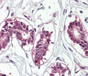 IHC staining of FFPE human breast tissue with ZBP-1 antibody. Required HIER: steamed antigen retrieval with pH6 citrate buffer; AP-staining.