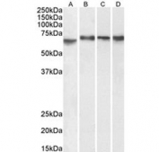 Western blot testing of A) human Caco-2, B) human K562, C) human HepG2 and D) mouse NIH-3T3 cell lysate with ZBP-1 antibody. Predicted molecular weight: ~64 kDa.