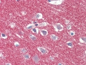 IHC testing of FFPE human brain (cortex) with AP2A1 antibody at 5ug/ml. Steamed antigen retrieval with citrate buffer pH 6, AP-staining.