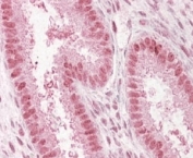 IHC staining of FFPE human uterus with Nup50 antibody at 4ug/ml. HIER: steamed with pH6 citrate buffer, AP-staining.
