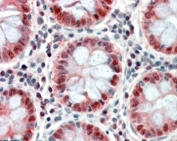 IHC testing of FFPE human colon tissue with PTCH1 antibody at 3.8ug/ml. HIER: steamed with pH6 citrate buffer, AP-staining.