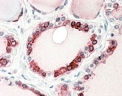 IHC staining of FFPE human thyroid gland with Thyroid peroxidase antibody at 5ug/ml. HIER: steamed with pH6 citrate buffer, AP-staining.