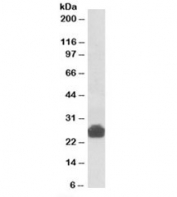 Western blot testing of rat liver lysate with Gsta5 antibody at 0.3ug/ml. Predicted molecular weight: ~25kDa.